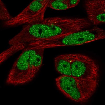 Immunocytochemistry/Immunofluorescence: EYA3 Antibody [NBP2-57061] - Staining of human cell line RH-30 shows localization to nucleoplasm & centrosome.