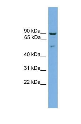 Western Blot: Cornulin Antibody [NBP1-57075] - HT1080 Whole Cell, concentration 1 ug/ml.