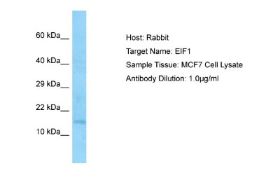 Western Blot: Eukaryotic translation initiation factor 1 Antibody [NBP1-98556] - Antibody Dilution: 1.0ug/ml Sample Tissue: MCF7 cell lysate.