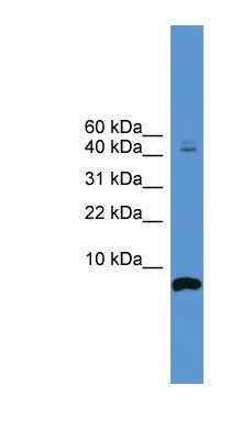 Western Blot: Cortistatin Antibody [NBP1-69148] - Titration: 0.2-1 ug/ml, Positive Control: 721_B cell lysate.