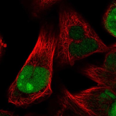 Immunocytochemistry/Immunofluorescence: HJURP Antibody [NBP2-58281] - Staining of human cell line RH-30 shows localization to nucleus & nucleoli.