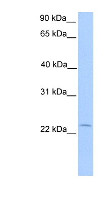 Western Blot: Annexin 2 Receptor Antibody [NBP1-53077] - Human Placenta lysate, concentration 0.2-1 ug/ml.