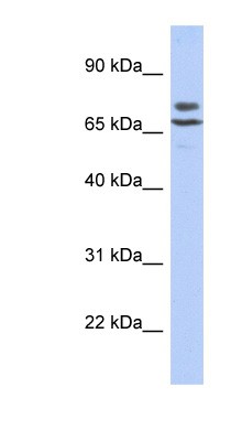 Western Blot: C3orf39 Antibody [NBP1-79304] - Titration: 0.2-1 ug/ml, Positive Control: SH-SYSY cell lysate.