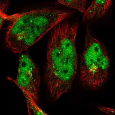 Immunocytochemistry/Immunofluorescence: OTUD1 Antibody [NBP2-58371] - Staining of human cell line RH-30 shows localization to nucleoplasm, nuclear bodies & the Golgi apparatus.