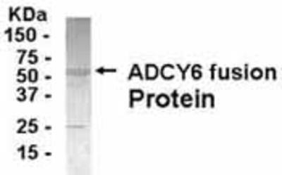 Western Blot: E coli-derived fusion protein as test antigen. Affi-anti-ATP7A IgY dilution: 1:2000, Goat anti-IgY-HRP dilution: 1:1000. Colorimetric method for signal development. (anti-ADCY6)