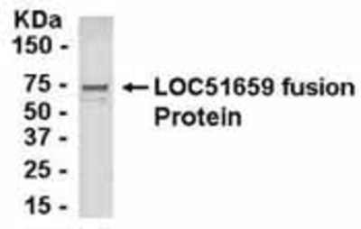 Western Blot: E coli-derived fusion protein as test antigen. Affinity-purified IgY dilution: 1:2000, Goat anti-IgY-HRP dilution: 1:1000. Colorimetric method for signal development. ( anti-GINS2 )
