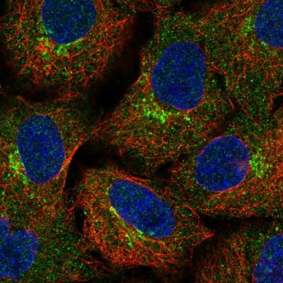 Immunocytochemistry/Immunofluorescence: BIRC6 Antibody [NBP2-57759] - Staining of human cell line A549 shows localization to the Golgi apparatus.