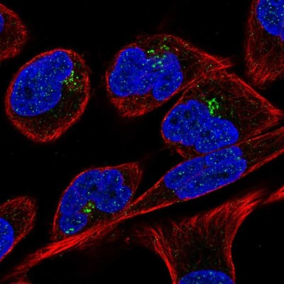 Immunocytochemistry/Immunofluorescence: RPGR Antibody [NBP2-57905] - Staining of human cell line RH-30 shows localization to the Golgi apparatus.