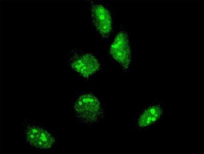 Immunocytochemistry/Immunofluorescence: GBX2 Antibody (1C11) [H00002637-M04] - Analysis of monoclonal antibody to GBX2 on HeLa cell. Antibody concentration 10 ug/ml