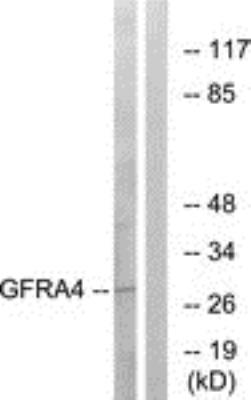 Western Blot: GFR alpha-4/GDNF R alpha-4/Persephin receptor Antibody [NBP1-68521] - Analysis of extracts from HeLa cells.