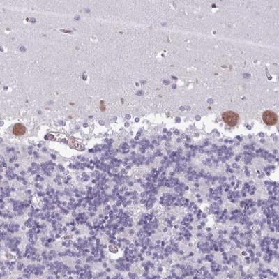 Immunohistochemistry-Paraffin: Amiloride-sensitive cation channel 3 Antibody [NBP2-14322] - Staining of human cerebellum shows moderate cytoplasmic positivity in Purkinje cells.