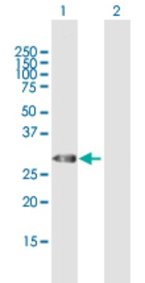 Western Blot: Thyrotropin Releasing Hormone Antibody [H00007200-B01P] - Analysis of TRH expression in transfected 293T cell line by TRH polyclonal antibody.  Lane 1: TRH transfected lysate(26.62 KDa). Lane 2: Non-transfected lysate.