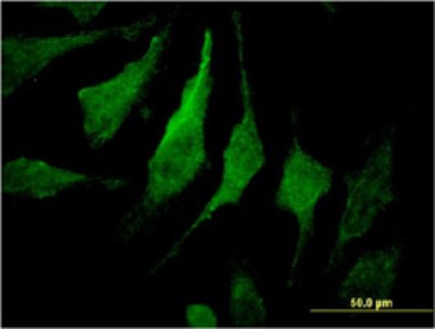 Immunocytochemistry/Immunofluorescence: MTMR14 Antibody (3B11) [H00064419-M01] - Analysis of monoclonal antibody to MTMR14 on HeLa cell. Antibody concentration 10 ug/ml.
