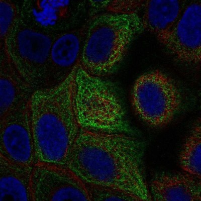 Immunocytochemistry/Immunofluorescence: Adenylate Cyclase 5 Antibody [NBP2-57976] - Staining of human cell line MCF7 shows localization to intermediate filaments.