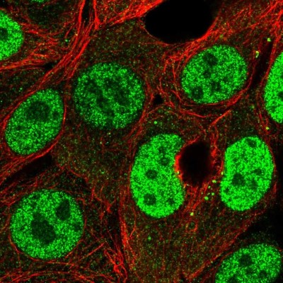Immunocytochemistry/Immunofluorescence: PMF1 Antibody [NBP2-57864] - Staining of human cell line MCF7 shows localization to nucleoplasm & vesicles.