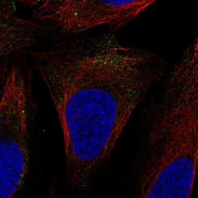 Immunocytochemistry/Immunofluorescence: SLC9A7 Antibody [NBP2-57956] - Staining of human cell line U-2 OS shows localization to vesicles.