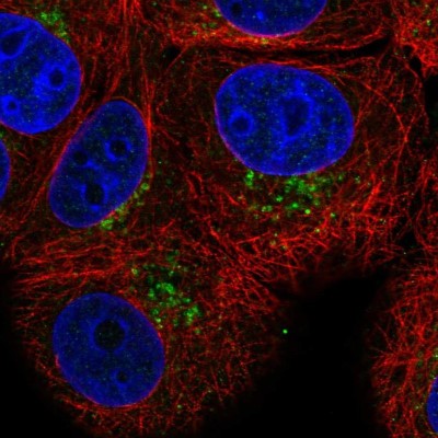 Immunocytochemistry/Immunofluorescence: PAQR4 Antibody [NBP2-57840] - Staining of human cell line MCF7 shows localization to vesicles.