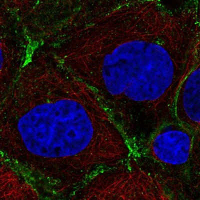 Immunocytochemistry/Immunofluorescence: PRKCDBP Antibody [NBP2-57897] - Staining of human cell line A-431 shows localization to plasma membrane.