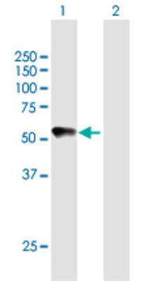 Western Blot: Chordin-like 2/CHRDL2 Antibody [H00025884-B01P] - Analysis of CHRDL2 expression in transfected 293T cell line by CHRDL2 polyclonal antibody.  Lane 1: CHRDL2 transfected lysate(49.61 KDa). Lane 2: Non-transfected lysate.