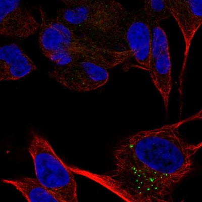 Immunocytochemistry/Immunofluorescence: CACNA2D2 Antibody [NBP2-57784] - Staining of human cell line SH-SY5Y shows localization to vesicles.