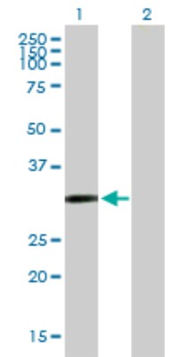 Western Blot: Cysteine Dioxygenase Type 1 Antibody [H00001036-B01P] - Analysis of CDO1 expression in transfected 293T cell line by CDO1 polyclonal antibody.  Lane 1: CDO1 transfected lysate(22 KDa). Lane 2: Non-transfected lysate.