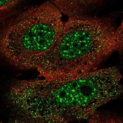 Immunocytochemistry/Immunofluorescence: FoxJ3 Antibody [NBP2-57077] - Staining of human cell line U-2 OS shows localization to nuclear speckles & vesicles.