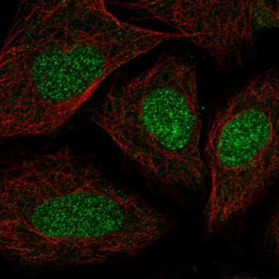 Immunocytochemistry/Immunofluorescence: SYCE2 Antibody [NBP2-57063] - Staining of human cell line SiHa shows localization to nucleoplasm.