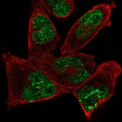Immunocytochemistry/Immunofluorescence: ANKRD17 Antibody [NBP2-57107] - Staining of human cell line RH-30 shows localization to nucleoplasm.
