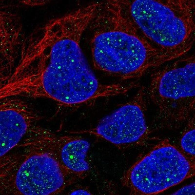 Immunocytochemistry/Immunofluorescence: AMER1 Antibody [NBP2-57231] - Staining of human cell line CACO-2 shows localization to nuclear bodies & vesicles.