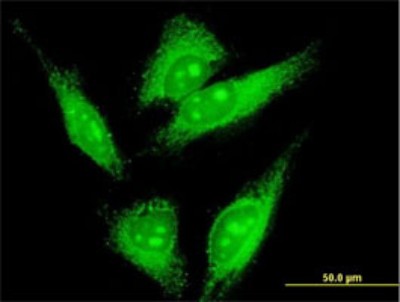 Immunocytochemistry/Immunofluorescence: LMO7 Antibody (4B4) [H00004008-M01] - Analysis of monoclonal antibody to LMO7 on HeLa cell. Antibody concentration 10 ug/ml.