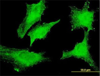 Immunocytochemistry/Immunofluorescence: Dexras1 Antibody (2D12) [H00051655-M01] - Analysis of monoclonal antibody to RASD1 on HeLa cell. Antibody concentration 10 ug/ml.