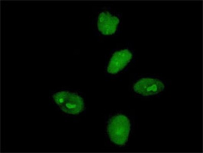 Immunocytochemistry/Immunofluorescence: MKRN3 Antibody (2E10) [H00007681-M01] - Analysis of monoclonal antibody to MKRN3 on HeLa cell. Antibody concentration 10 ug/ml.
