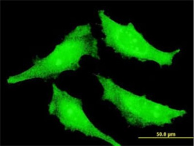 Immunocytochemistry/Immunofluorescence: SENP7 Antibody (2D4) [H00057337-M01] - Analysis of monoclonal antibody to SENP7 on HeLa cell. Antibody concentration 10 ug/ml.