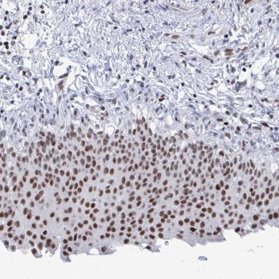 Immunohistochemistry-Paraffin: C15orf41 Antibody [NBP2-32583] - Staining of human urinary bladder shows moderate nuclear positivity in urothelial cells.