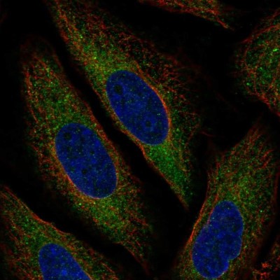 Immunocytochemistry/Immunofluorescence: MARCH6 Antibody [NBP2-58931] - Staining of human cell line SiHa shows localization to endoplasmic reticulum.