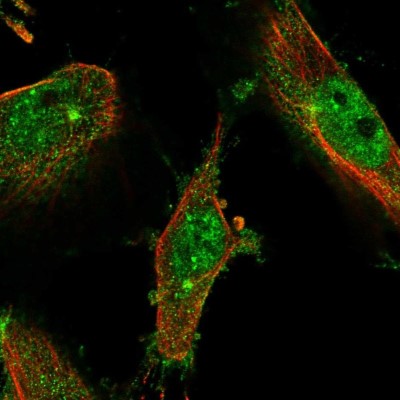 Immunocytochemistry/Immunofluorescence: LMTK2 Antibody [NBP2-58981] - Staining of human cell line U-251 MG shows localization to nuclear speckles, plasma membrane & microtubule organizing center.
