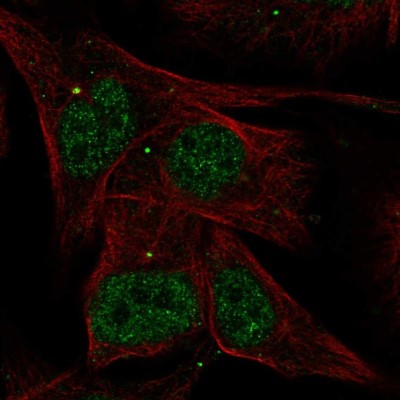 Immunocytochemistry/Immunofluorescence: AKNA Antibody [NBP2-56850] - Staining of human cell line SK-MEL-30 shows localization to nucleoplasm & centrosome.