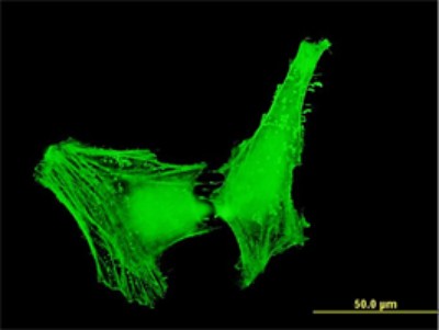 Immunocytochemistry/Immunofluorescence: ACTR1B Antibody (4E10) [H00010120-M05] - Analysis of monoclonal antibody to ACTR1B on HeLa cell. Antibody concentration 10 ug/ml