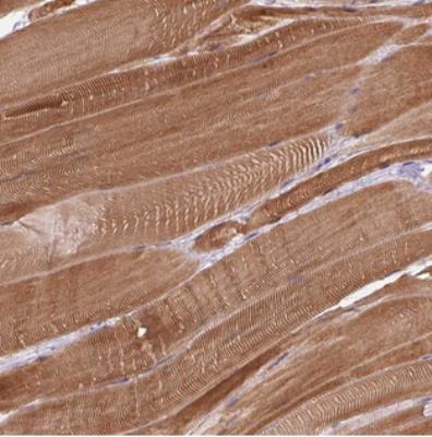 Immunohistochemistry: C20orf175 Antibody [NBP2-30962] - Staining of human skeletal muscle shows strong cytoplasmic positivity in myocytes.