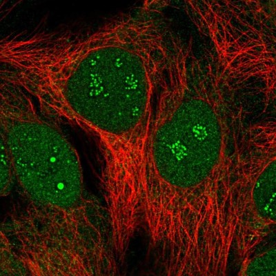 Immunocytochemistry/Immunofluorescence: SUMO-interacting Motif (SIM) Antibody [NBP2-55180] - Staining of human cell line CACO-2 shows localization to nucleus & nucleoli fibrillar center.