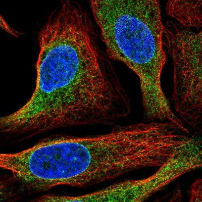 Immunocytochemistry/Immunofluorescence: Signal Peptide Peptidase Antibody [NBP2-54935] - Staining of human cell line U-2 OS shows localization to endoplasmic reticulum.