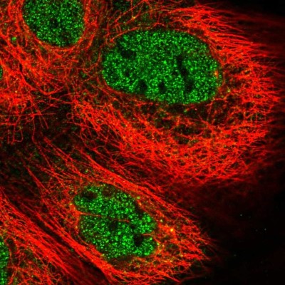 Immunocytochemistry/Immunofluorescence: PARP12 Antibody [NBP2-57018] - Staining of human cell line A-431 shows localization to nucleoplasm.