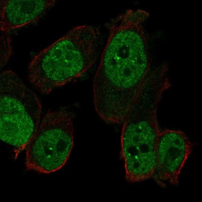 Immunocytochemistry/Immunofluorescence: RAPGEF5 Antibody [NBP2-57362] - Staining of human cell line PC-3 shows localization to nucleoplasm & nuclear bodies.