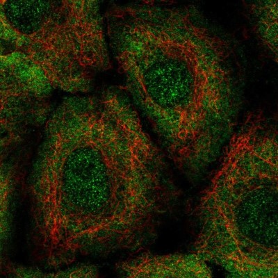 Immunocytochemistry/Immunofluorescence: Leukotriene B4 Receptor 2 Antibody [NBP2-57352] - Staining of human cell line A549 shows localization to nucleoplasm & plasma membrane.