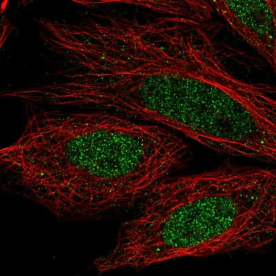 Immunocytochemistry/Immunofluorescence: CCDC36 Antibody [NBP2-57300] - Staining of human cell line SiHa shows localization to nucleoplasm.