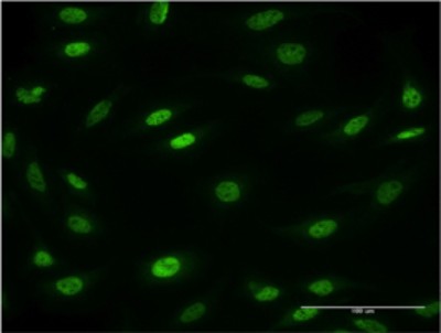 Immunocytochemistry/Immunofluorescence: MESP2 Antibody (1C8) [H00145873-M01] - Analysis of monoclonal antibody to MESP2 on HeLa cell. Antibody concentration 10 ug/ml.