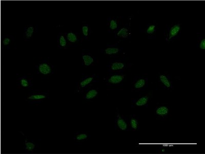 Immunocytochemistry/Immunofluorescence: HMX2 Antibody (2D2) [H00003167-M09] - Analysis of monoclonal antibody to HMX2 on HeLa cell. Antibody concentration 10 ug/ml