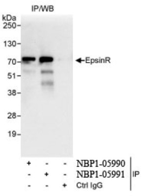 Western Blot: Clathrin interactor 1 Antibody [NBP1-05990] - Whole cell lysate (1 mg for IP,  20% of IP loaded) from HeLa cells. Antibodies: Affinity purified  rabbit anti-EpsinR antibody used for IP at 3 mcg/mg  lysate.