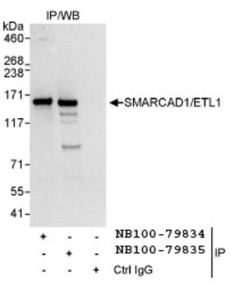 Immunoprecipitation: SMARCAD1 Antibody [NB100-79834] - Detection of Human SMARCAD1/ETL1 by Western Blot of  Immunoprecipitates. Samples: Whole cell lysate (1 mg for IP,  20% of IP loaded) from HeLa cells. Antibodies: Affinity purified  rabbit anti-SMARCAD1/ETL1 antibody NB100-79834 used for IP  at 3 mcg/mg lysate. SMARCAD1/ETL1 was also  immunoprecipitated by rabbit anti-SMARCAD1/ETL1 antibody  NB10-79835, which recognizes a downstream epitope. Detection:  Chemiluminescence with an exposure time of 3 seconds
