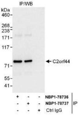 Western Blot: C2orf44 Antibody [NBP1-78736] - Whole cell lysate (1 mg for IP, 20% of IP loaded) from 293T cells.  Affinity purified rabbit anti-C2orf44 antibody used for IP at 6 mcg/mg lysate.  C2orf44 was also immunoprecipitated by rabbit anti-C2orf44 antibody NBP1-78737, which recognizes a downstream epitope.